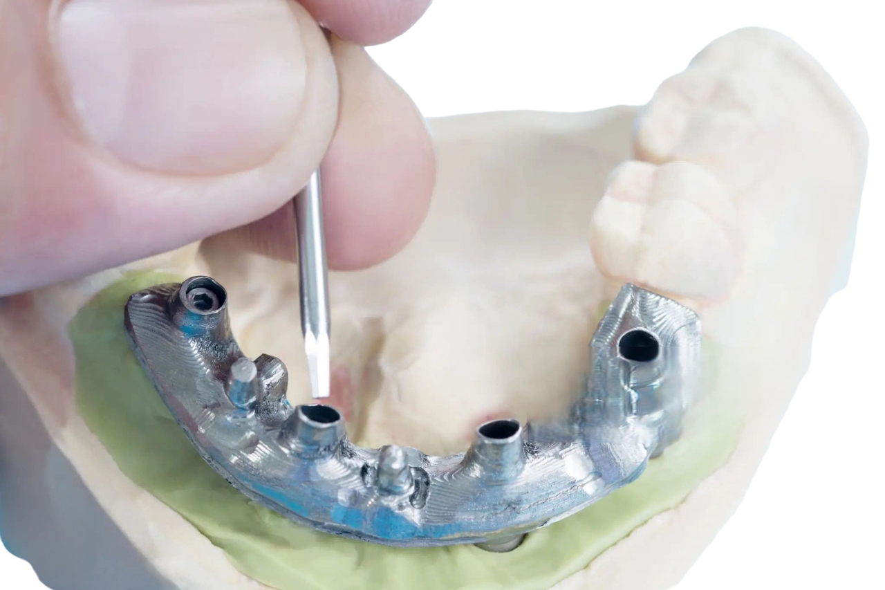 Zygomatic Implants New York Price